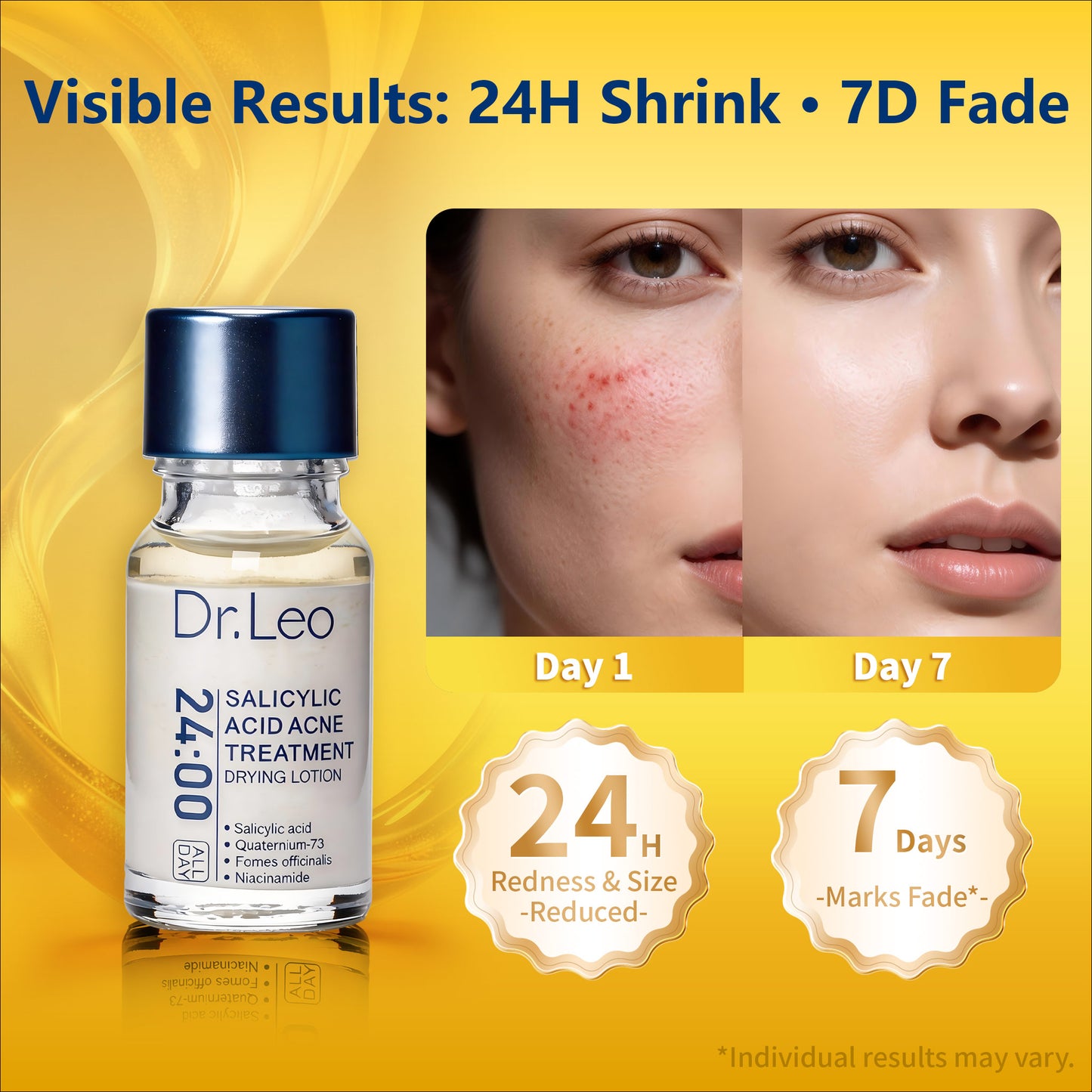 Drying Lotion Plus – Visibly Shrink Pimples in 24 Hours & Fade Dark Spots in 7 Days | 20ml