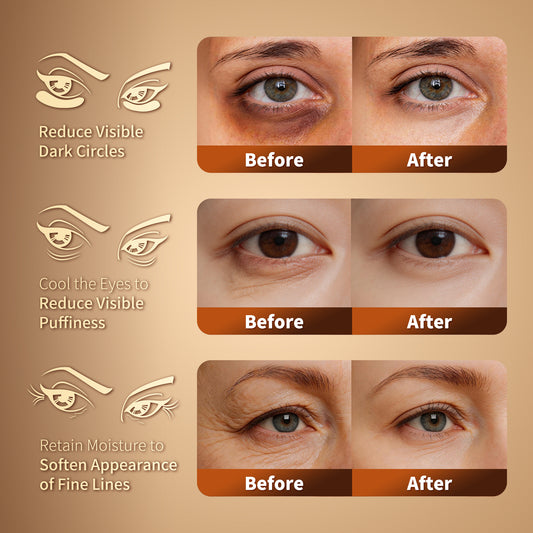 Grace & Stella Gold Under Eye Masks – De-Puff & Brighten Dark Circles in 15 Minutes | Vegan, Cruelty-Free